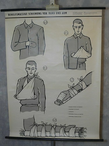 Schienung von hand und - "schienung,